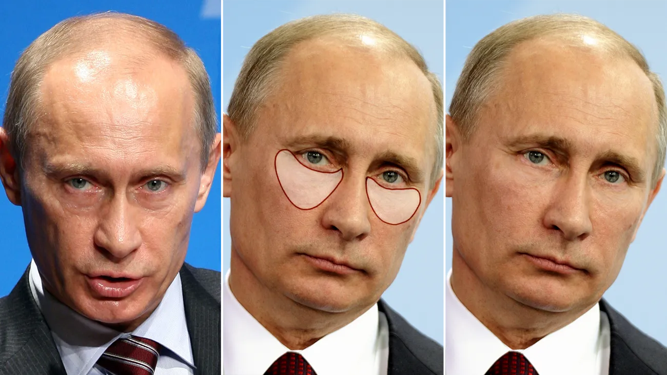 Vladimir Putin to put an end to his botox treatment? Find out why