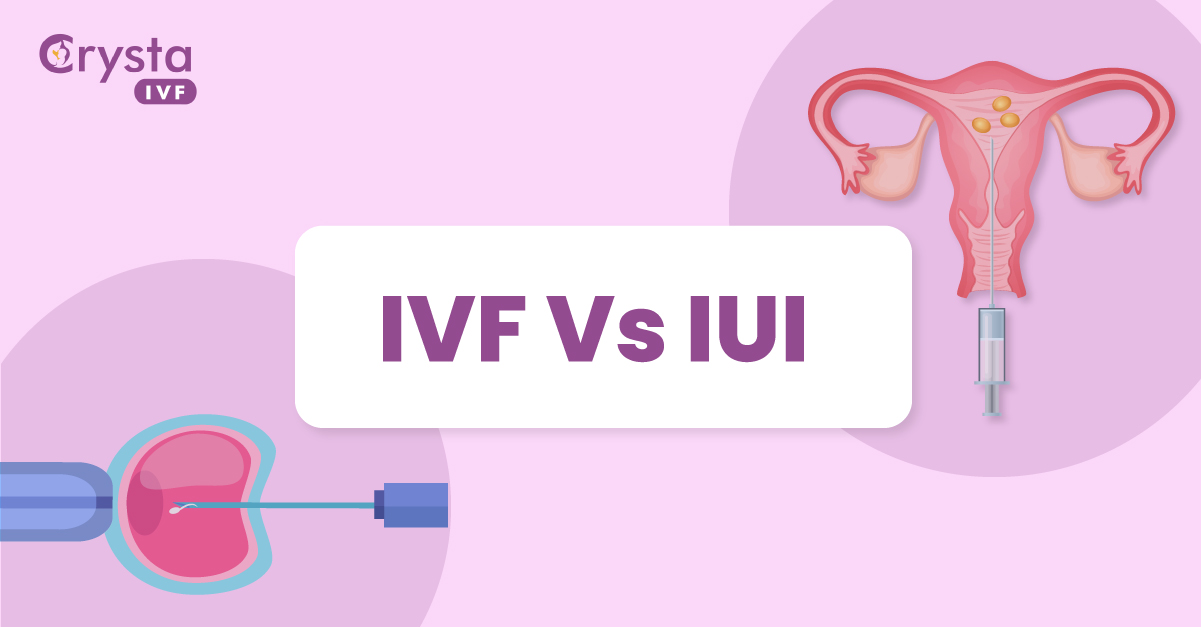 IVF v/s IUI: Which one is right for you?