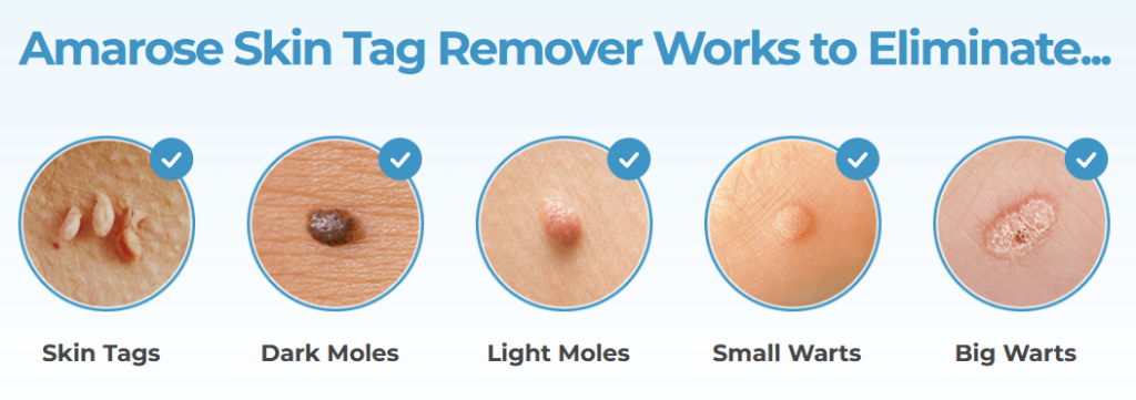 Amarose Skin Tag Remover Serum Benefits