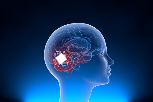 Inserting computer chip inside human brains Neuralink by Elon musk 2022