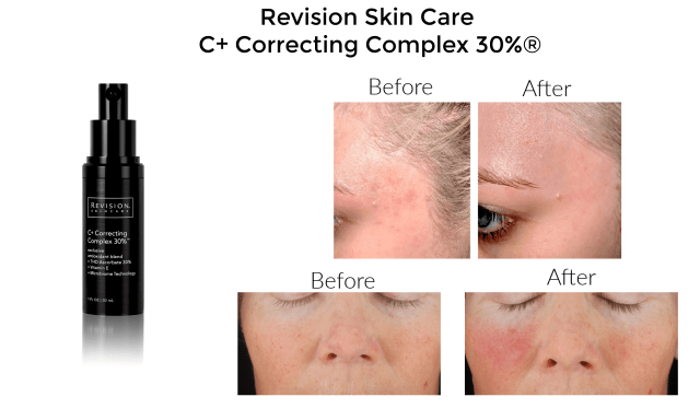 ReVision Skin Care 2 1