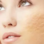 Why Is Seeing A Dermatologist Critical For Your Skin?