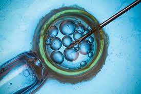 The Future of Assisted Reproductive Technology: Emerging Trends and Advancements