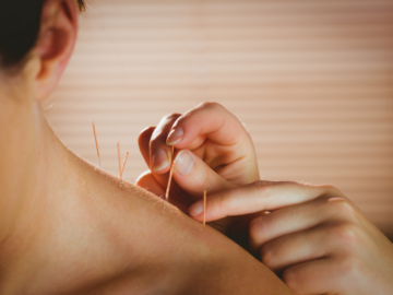 Relief with Acupuncture Neck Pain Treatment