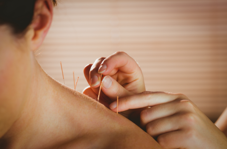 Relief with Acupuncture Neck Pain Treatment