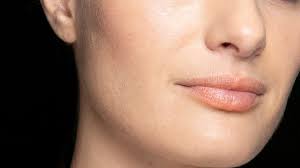Injectable Rhinoplasty – Here’s What No One Talks About
