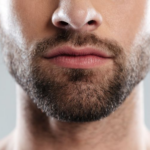 The Benefits of Minoxidil for Facial Hair Growth
