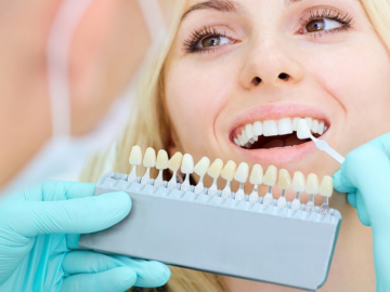 Professional teeth whitening, what does it have that the rest don't?