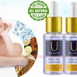 U Renew Skin Tag Remover Reviews {Top 7 Skin Tag Remover Serum} Best Glowing Skin Formula Amarose [U Renew Skin Tag Remover] OFFICIAL USA Report 2023