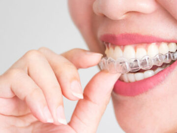 The Science Behind Clear Aligners: How They Work to Transform Your Smile