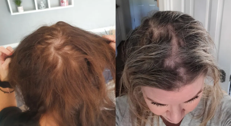 OLAPLEX Lawsuit: Unraveling the Hair Care Controversy