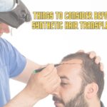 Things to Consider Before Synthetic Hair Transplant
