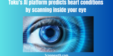 Toku’s AI platform predicts heart conditions by scanning inside your eye