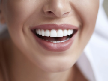 Post-Whitening Care: Essential Tips for Brighter Smiles