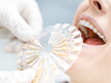 The Brighter Choice: Visiting a Cosmetic Dentist for Teeth Whitening