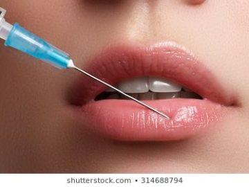 A Quick Guide to Aesthetic Lip Surgery Recovery