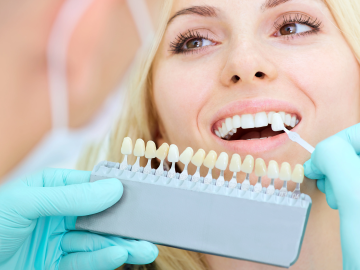 Best Teeth Whitening Supplies: 5 Picks for Dazzling Results